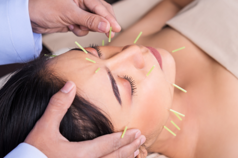 Understanding Acudetox A Complementary Therapy for Addiction Recovery